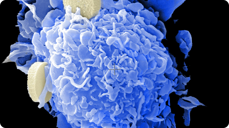 META Nominates MP-5342 as First Pre-clinical Candidate for Inflammatory Bowel Disease 2025/10/15